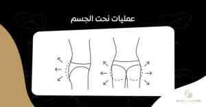 ما تحتاج معرفته عن عمليات نحت الجسم:الفوائد و النتائج المتوقعة